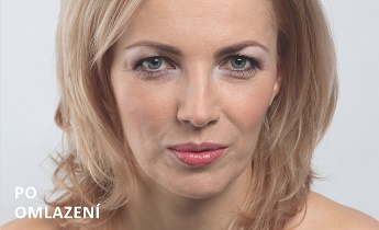 Nalíčená po omlazení