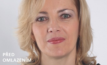 Nalíčená před omlazením